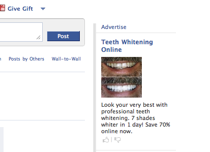 teeth whitening ads. I#39;m thinking, #39;Teeth whitening